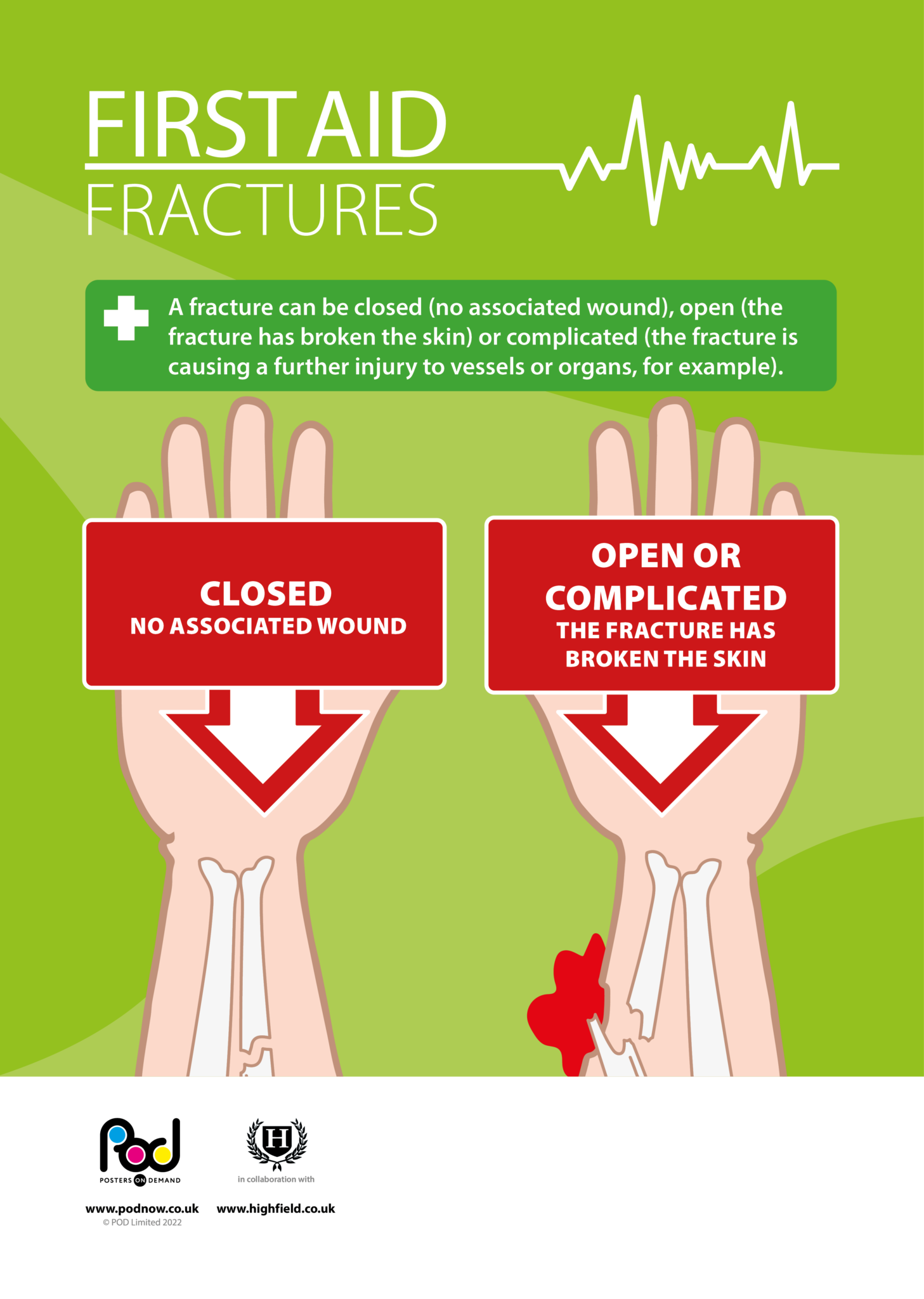 First Aid - Fractures | POD | Posters On Demand