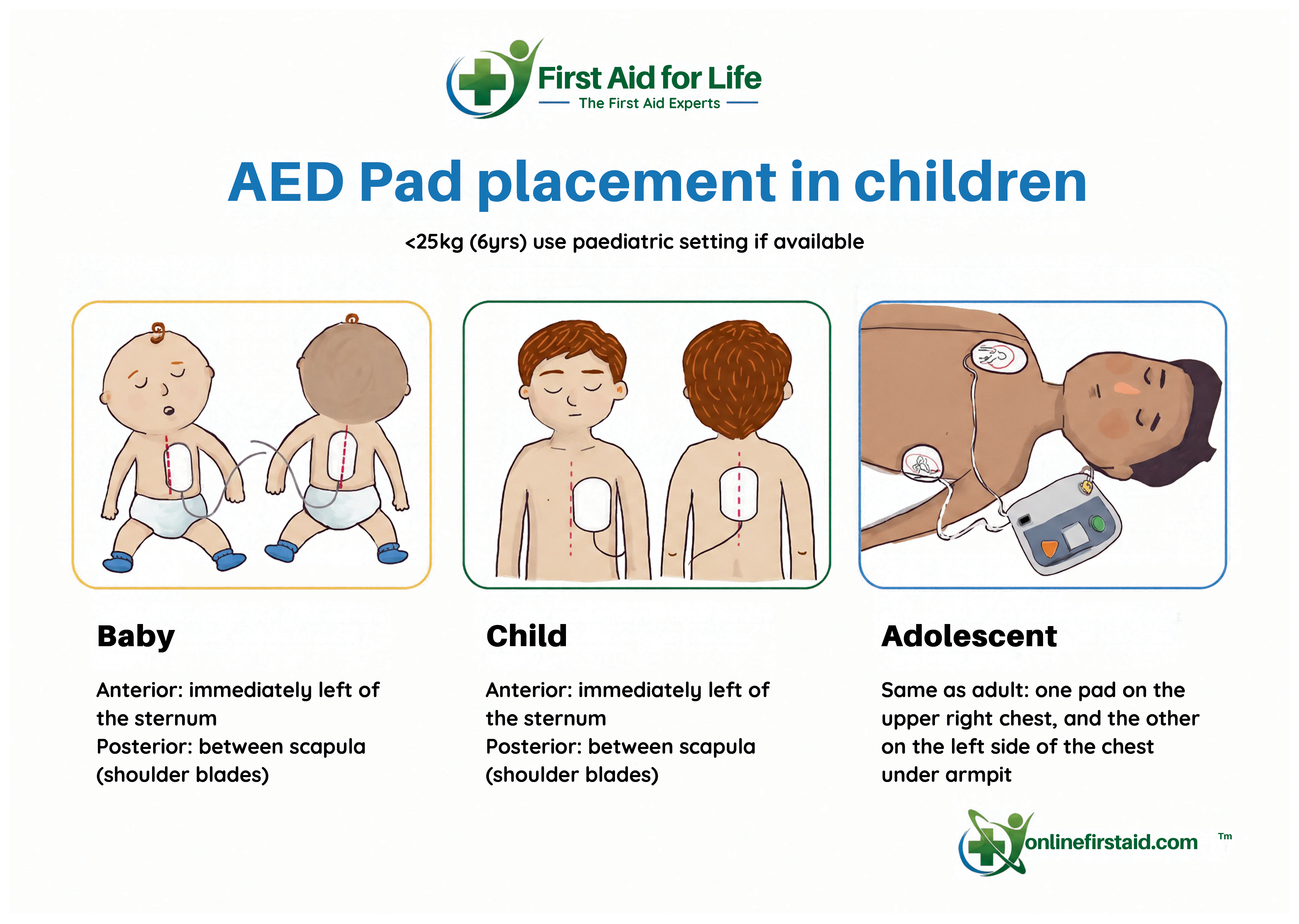 AED Pad Placement in Children