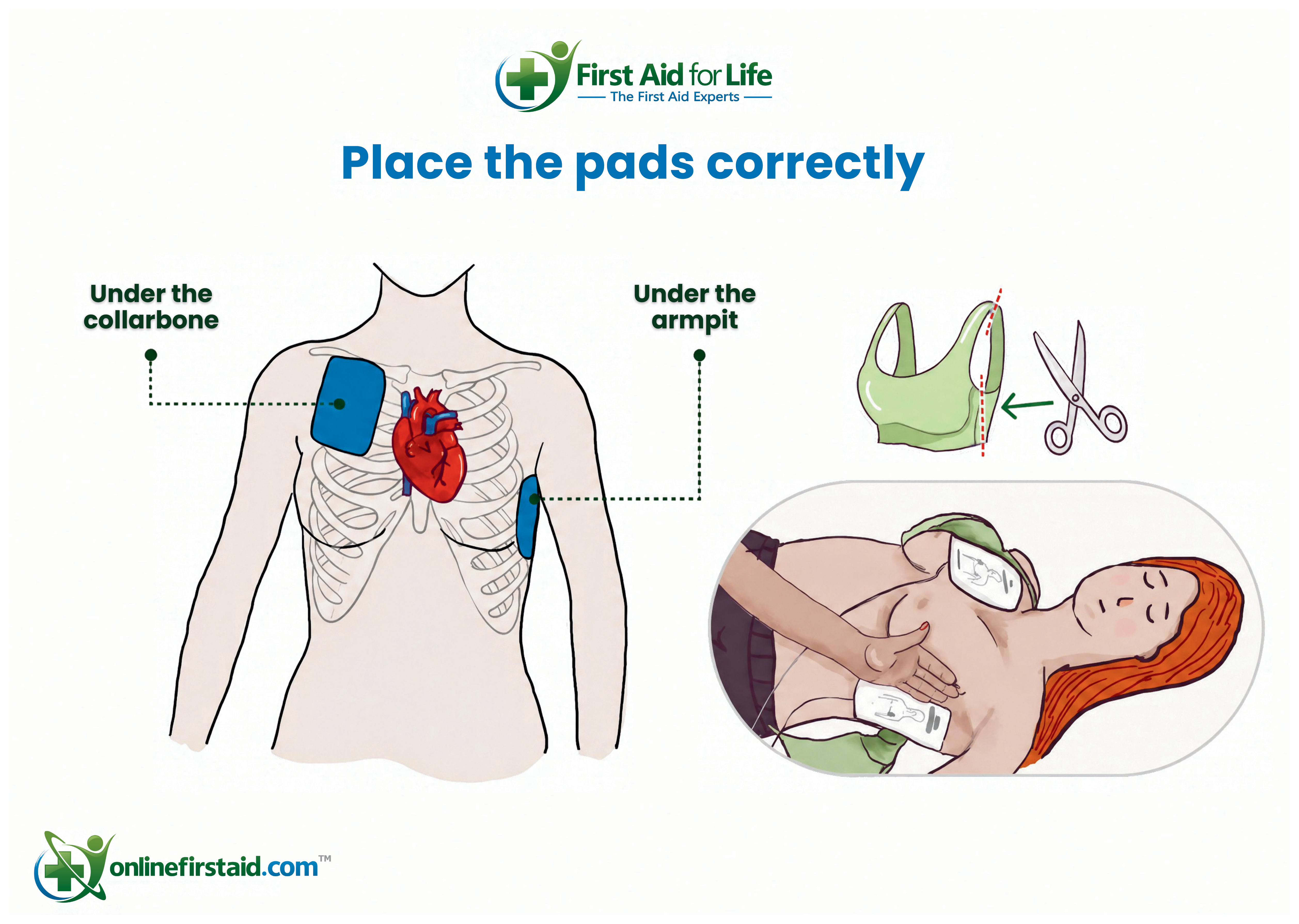 AED pad placement - women