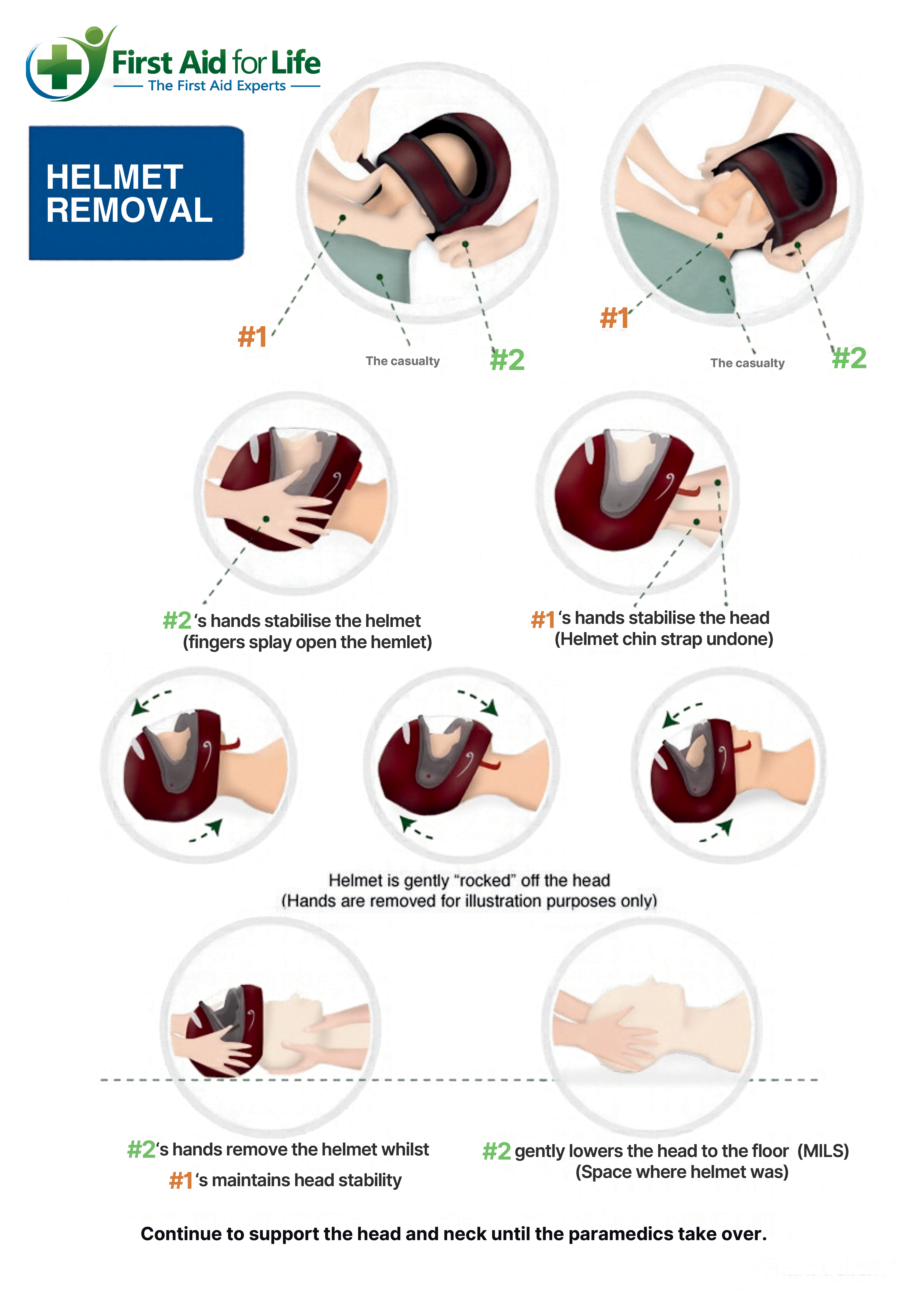 Helmet removal