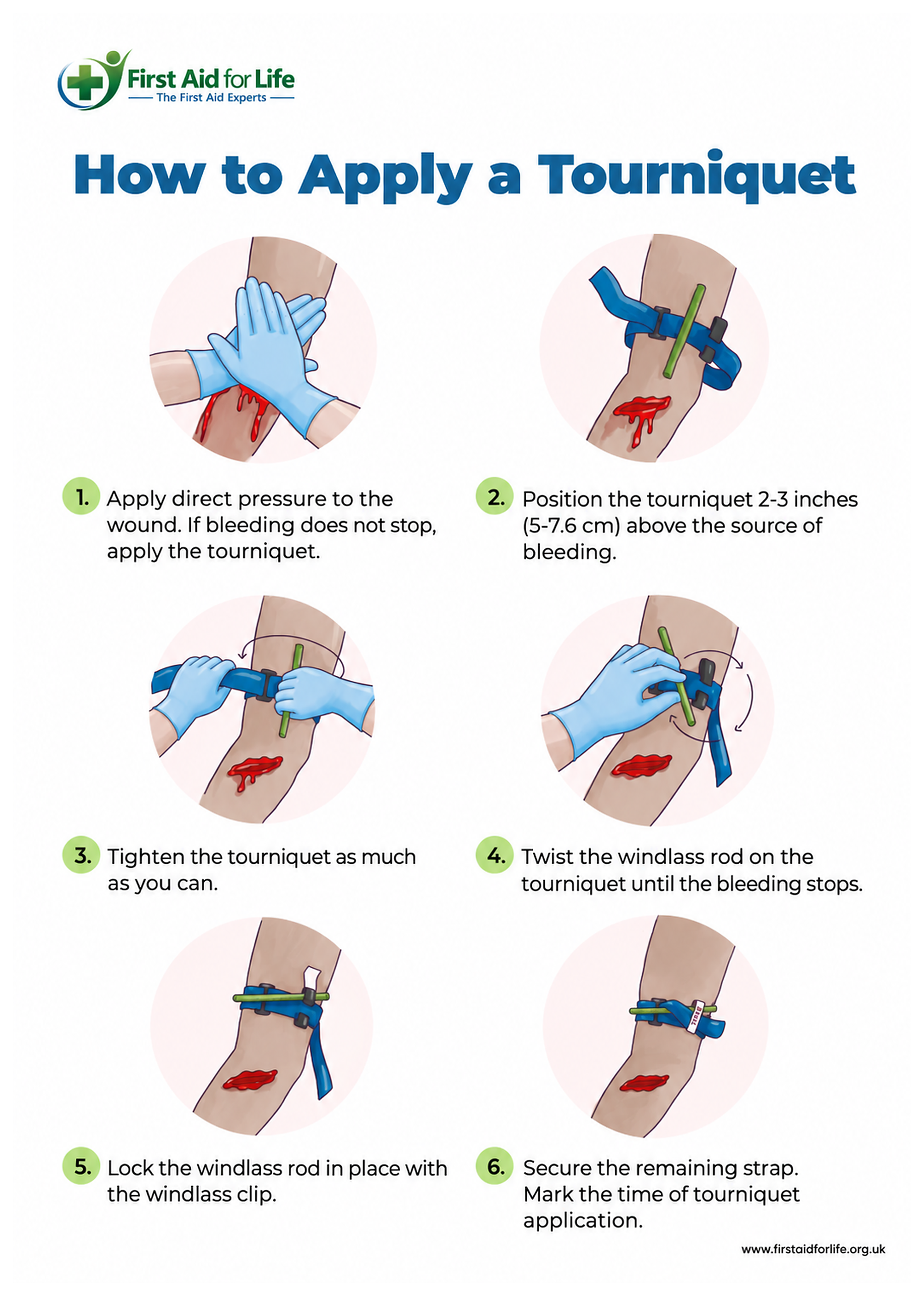 How to Apply a Tourniquet